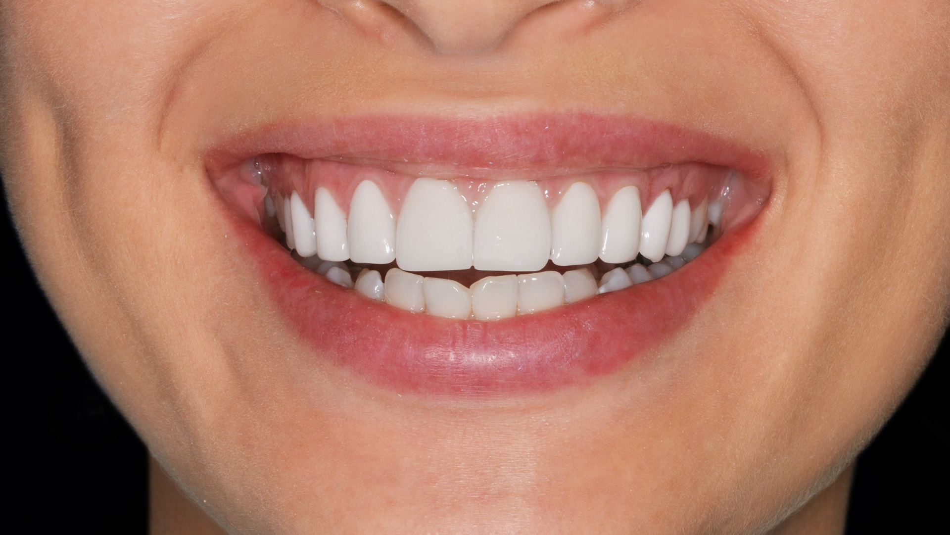 Scientists Find Link between Healthy Teeth and Longer Life