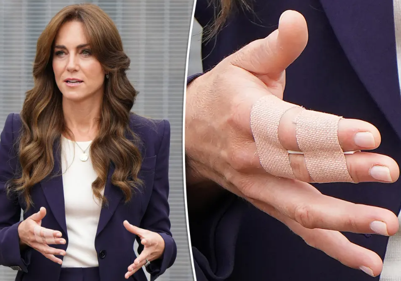 Kate Middleton injured after jumping on trampoline with her kids 